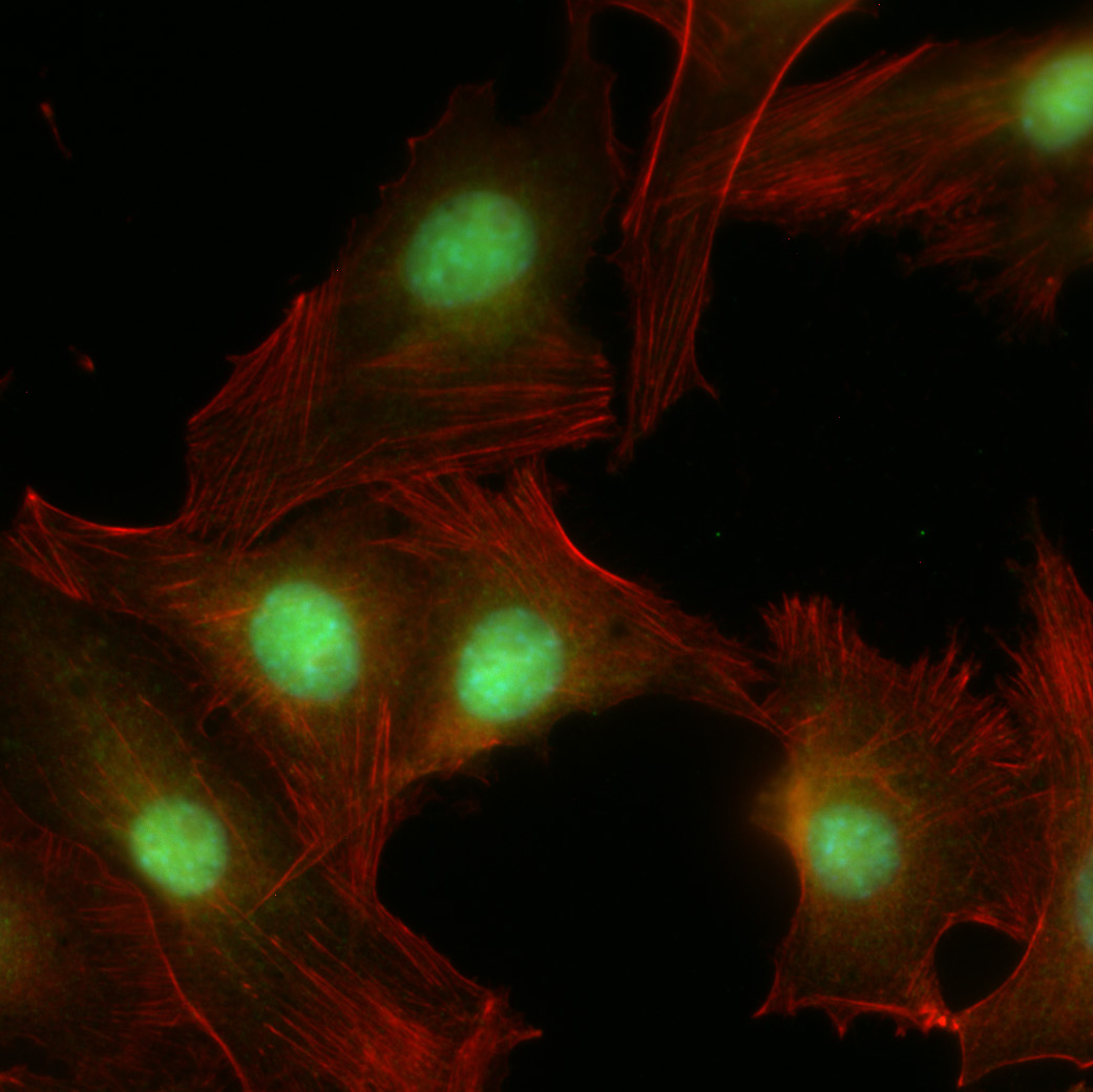 CXCR4 CXCR7 effects in melanoma &  melanocytes