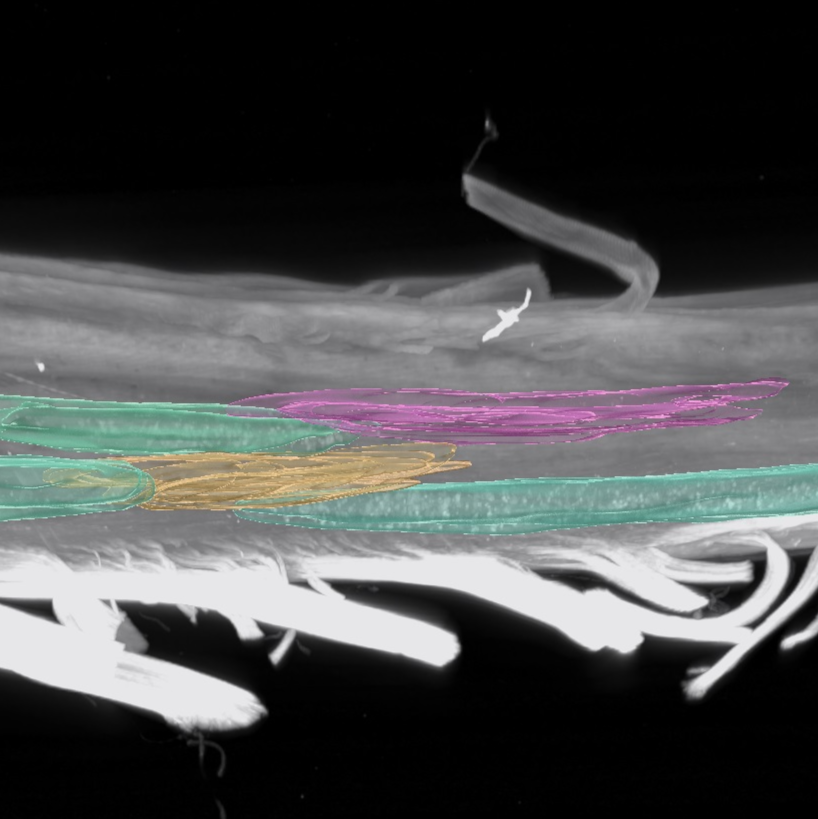 Segmentation of motor pools in cleared spinal cord 