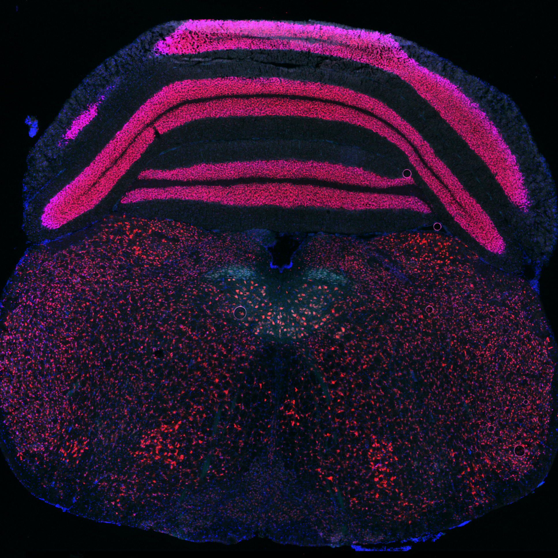 Hypoglossal motor neuron stain of mouse brainstem