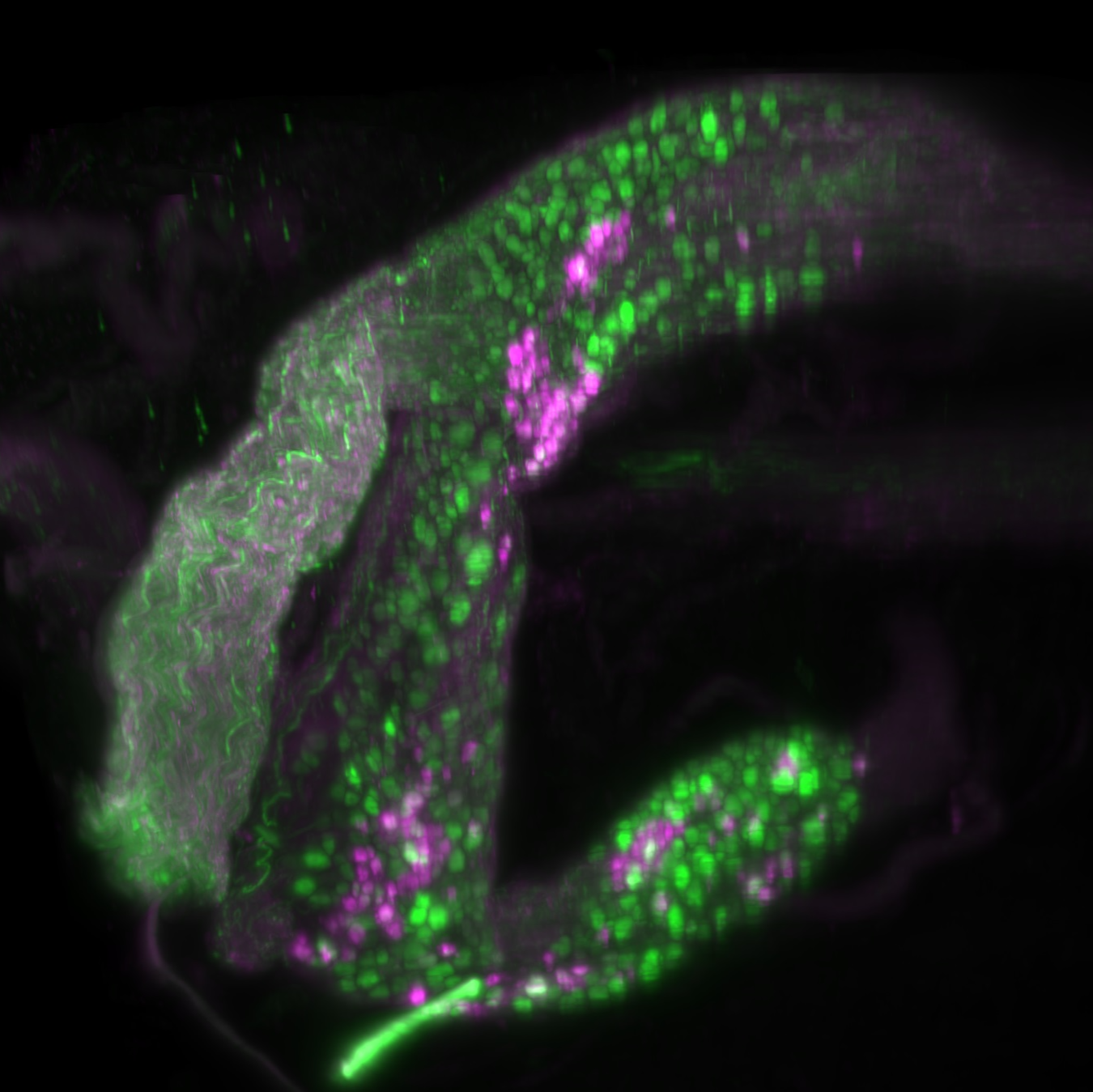 Immunolabelling and clearing of large samples of peripheral nerve tissue