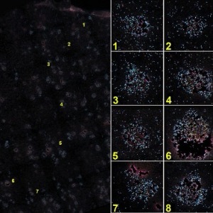 Sequential smFISH Allen Institute
