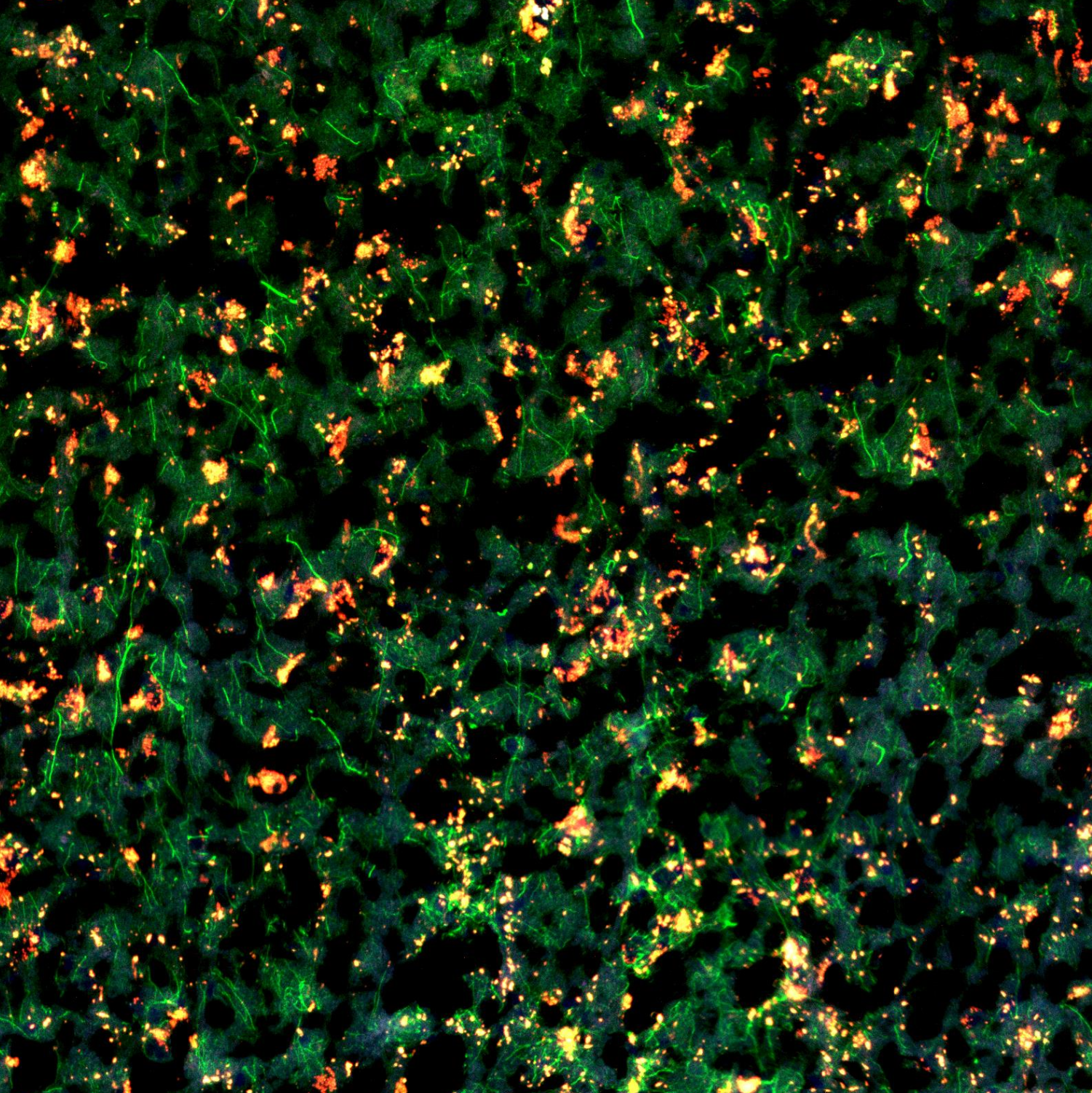 GeoMx RNA slide prep for fresh frozen human post-mortem brain tissue