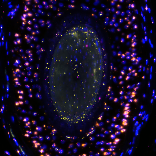Tissue processing and RNA extraction for multi-omic molecular analyses of human surgical samples