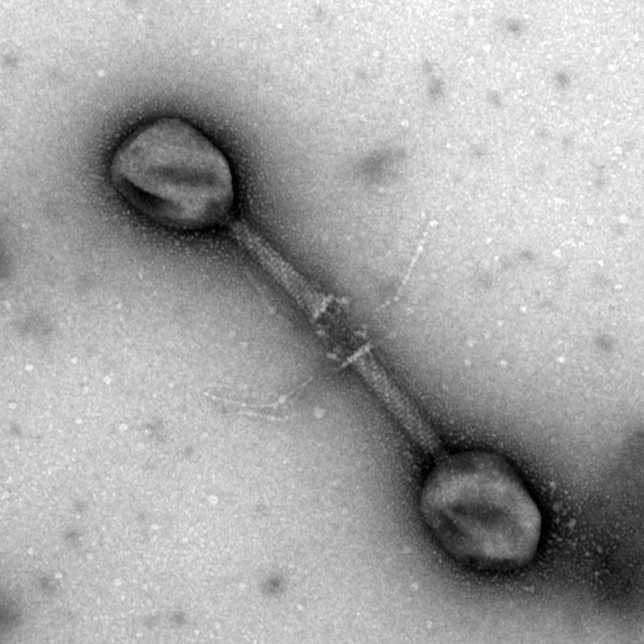 Negative staining of macromolecules, viruses and isolated organelles using uranyl acetate for transmission electron microscopy analysis
