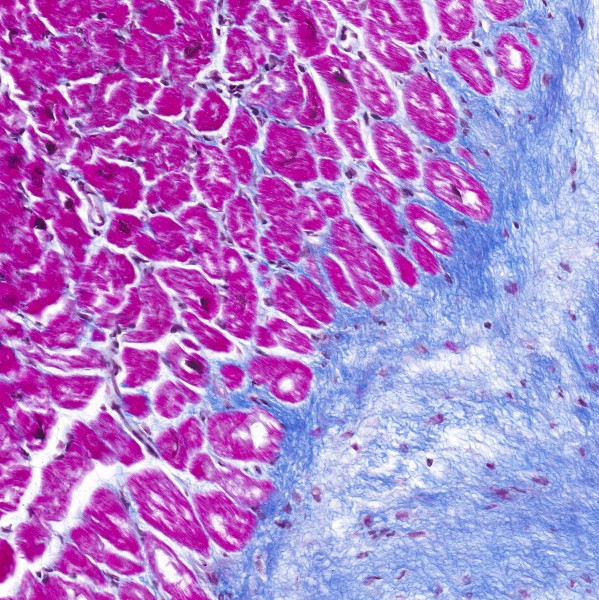 Masson’s Trichrome staining for histology