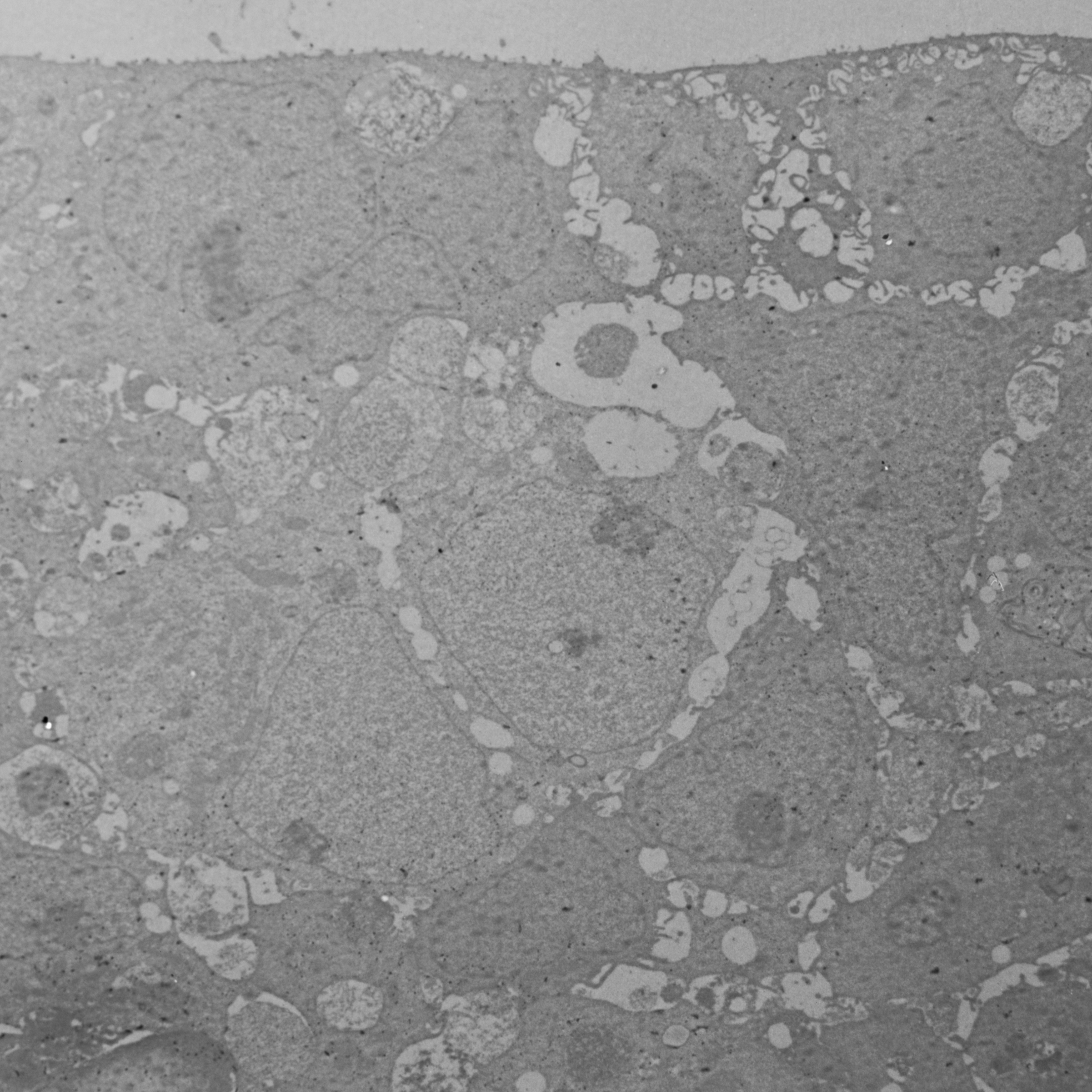 Epon embedding and ultrathin sectioning of spheroids for transmission electron microscopy