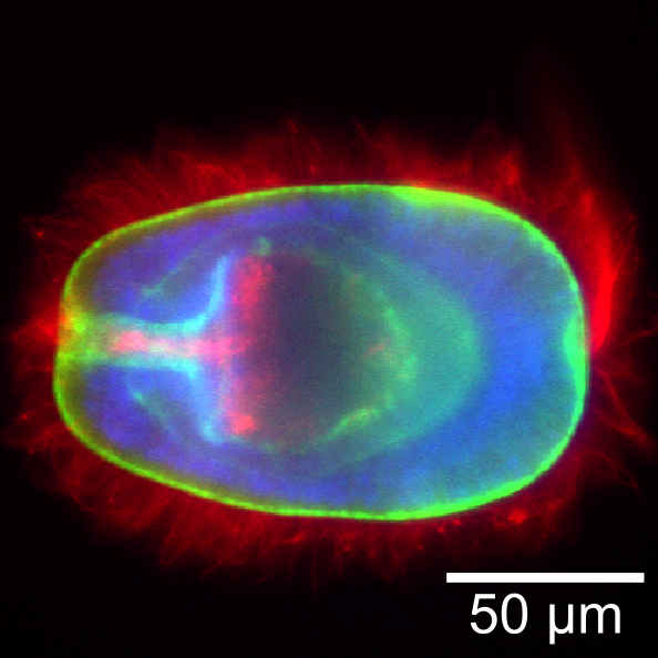 Icon representing the file Fixation and immunohistochemical staining of Aiptasia larvae