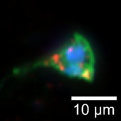 Icon representing the file Fixation of Aiptasia larvae for observation of native fluorescence of fluorescent proteins