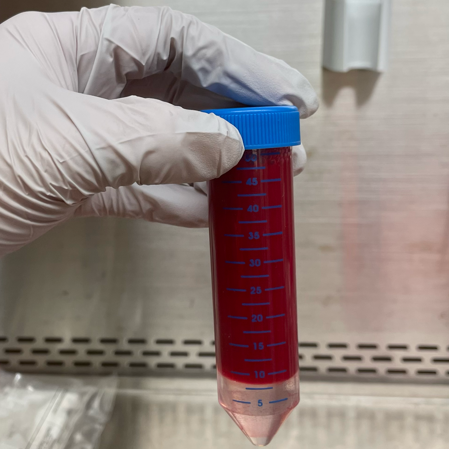Human Whole Blood PBMC Isolation