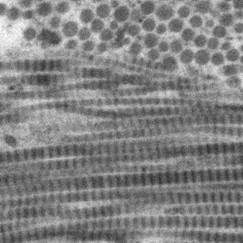A block staining method using ethanolic phosphotungstic acid for the visualisation of collagens in the TEM