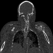 REVA #2: Computed Tomography (CT) of Embalmed Cadaver