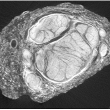 REVA #10: Microcomputed Tomography (MicroCT) of Excised Cadaveric Human Vagus Nerves