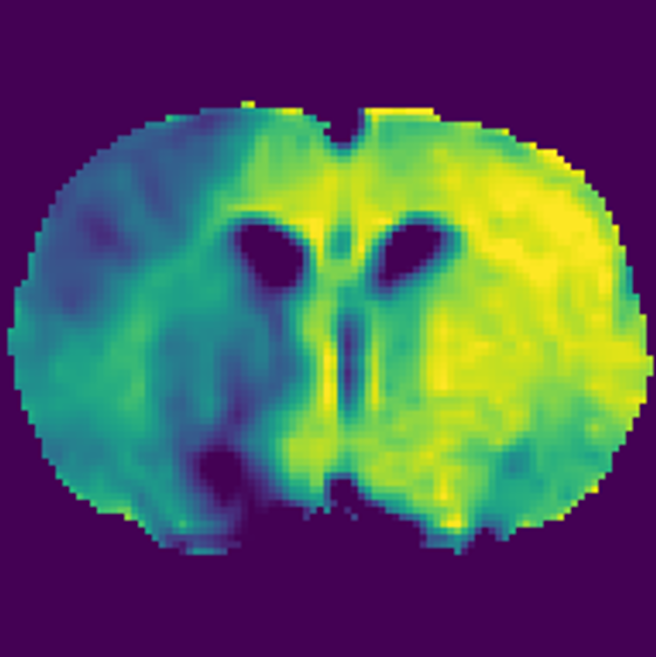 2-deoxy-D-glucose chemical exchange sensitive spin-lock (CESL) MRI of the rodent brain