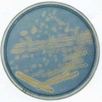 Chrome Azural S (CAS) Plate Assay for Iron-Binding Compounds